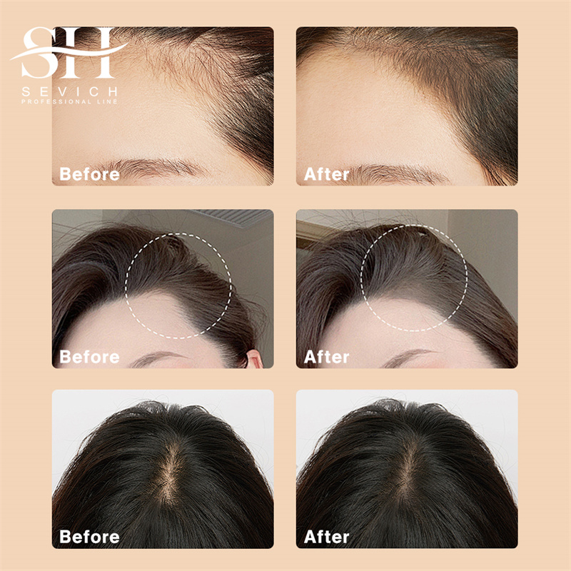 SEVICH 12g Hairline Powder Wit - Rooting Hormone Powder 评论和价格